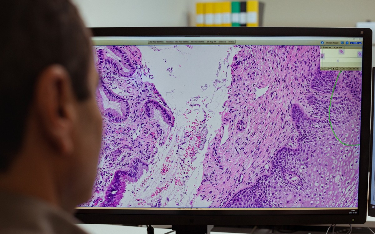 Unilabs digital pathology