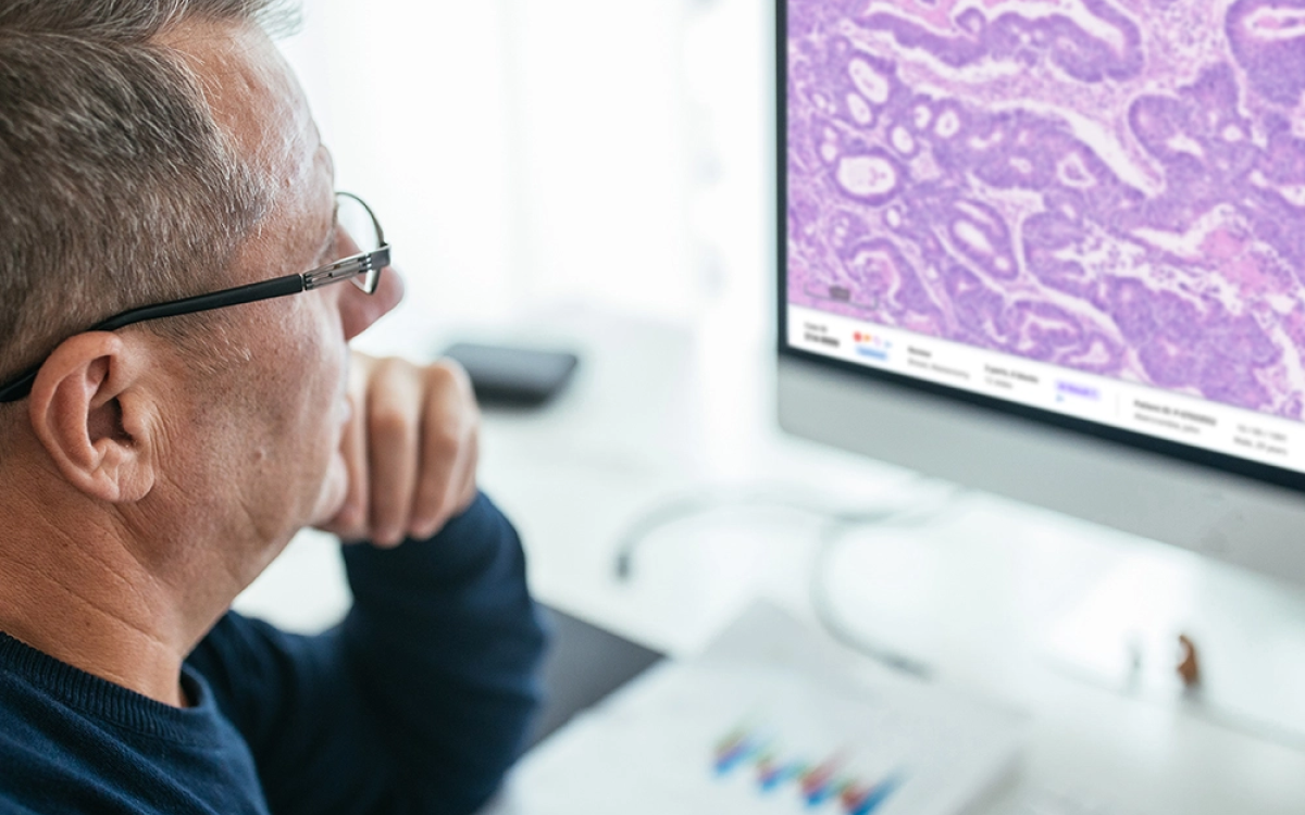 Unilabs Selects Proscia’s AI For Skin Pathology